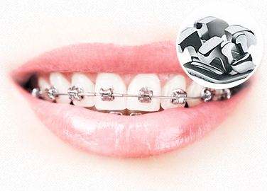 上海腹部抽脂会不会反弹呢，术后注意什么