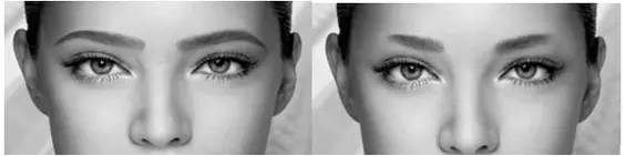 上海吸脂瘦脸有后遗症吗,多久可以洗脸呢