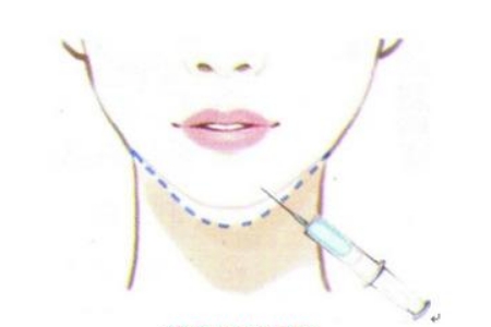 上海治疗毛孔粗大多少钱?治疗后多久可以碰水