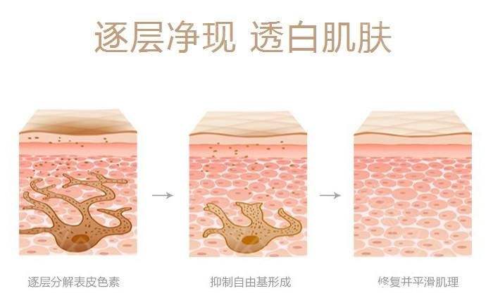 上海激光祛黄褐斑效果如何，适合哪些人群呢