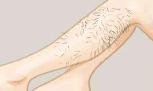 上海玻尿酸注射隆鼻多少钱,注射后多久可以碰鼻子