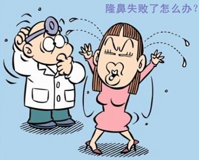 上海自体软骨隆鼻哪儿医院好，术后几天消肿呢