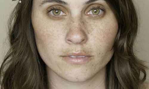 上海多大年龄适合眼袋抽脂,术后眼睛可以碰水吗