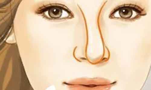 上海激光祛斑后反黑风险有吗，祛斑后如何护理