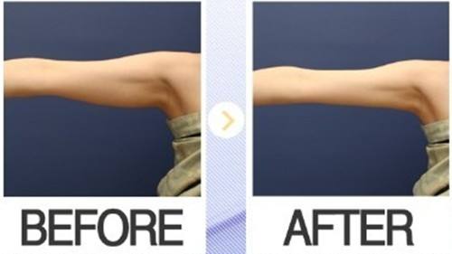 上海美莱吴海龙主任晋级“金刀赛”总决赛