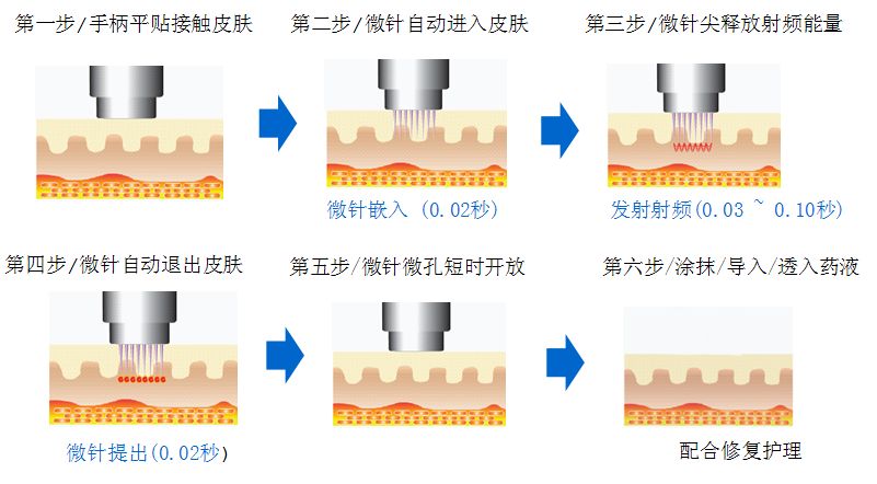 上海隆鼻注射医院哪家好,效果可以保持一年吗