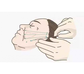 在上海割双眼皮要多少钱