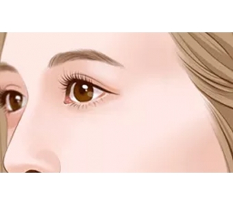 上海注射瘦脸针一针能维持多久