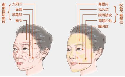 上海水光针对皮肤有害吗,一般需要打几次呢