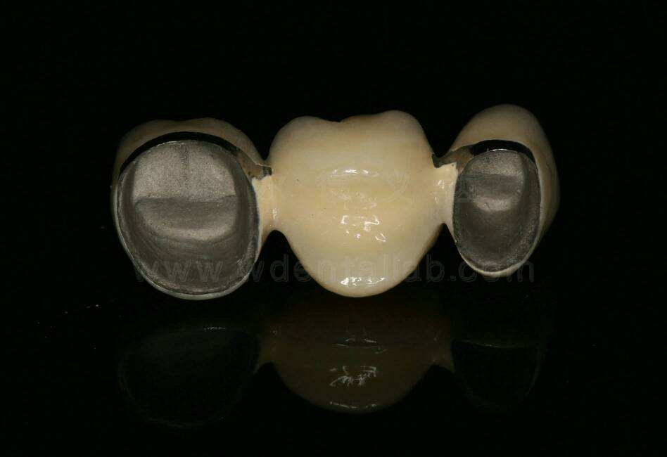 上海丰胸手术有疤痕吗?有疤痕怎么办?