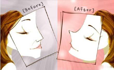 鼻头缩小手术需要多少钱,上海做贵吗?