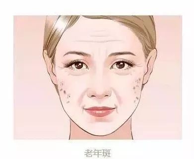 上海开眼角多少钱,花费“贵”吗?