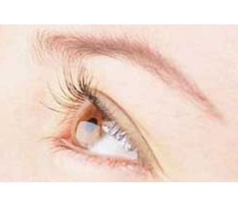 上海较久脱毛有什么副作用嘛