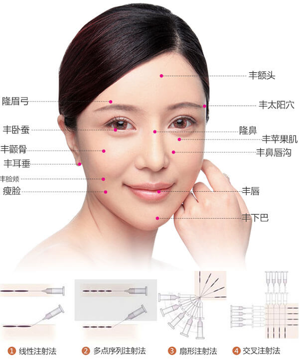 上海做内切去眼袋手术 哪家医院效果好呢