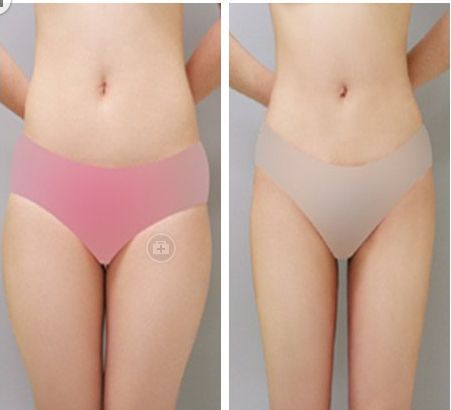 上海小腿吸脂后多久消肿恢复?