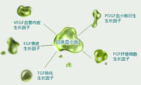 上海开眼角开大需要花多少钱呢
