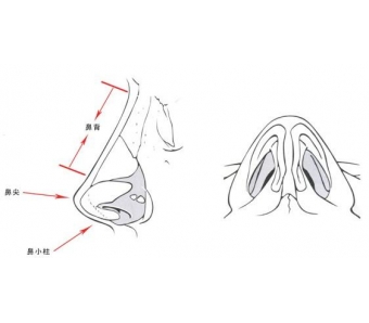 美莱双眼皮科普：做双眼皮是埋线好还是切开好？