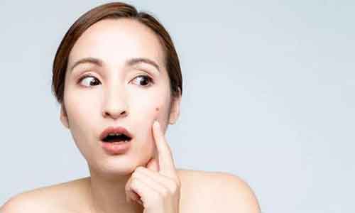 上海开眼角有疤痕怎么办?