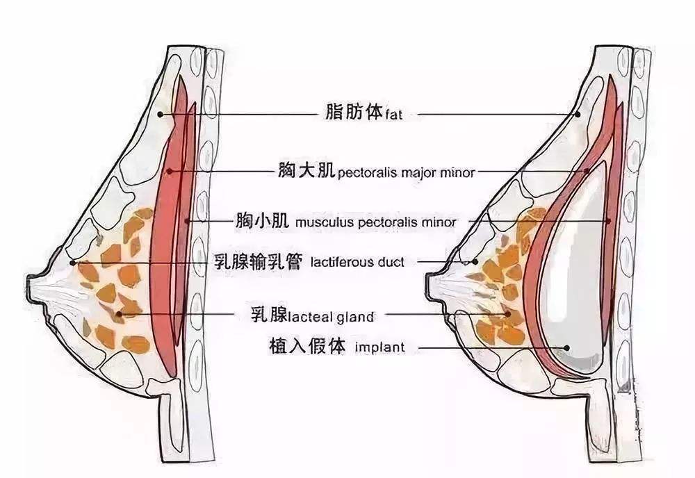 美莱鼻孔缩小手术术前、术后要注意什么?