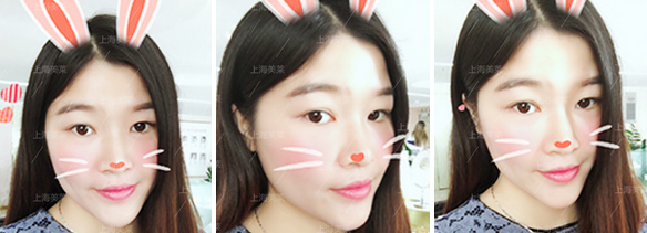 第四届整形节暨第二届金刀赛决赛在上海美莱隆重启幕!