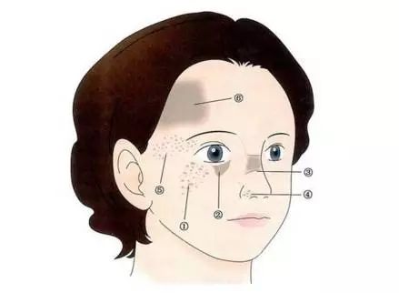 美莱开眼角的效果怎么样,优势有哪些?