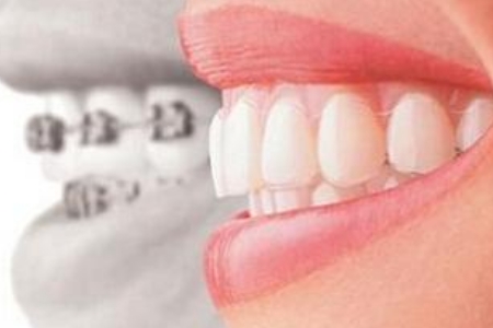 美莱注射隆鼻会影响工作吗?