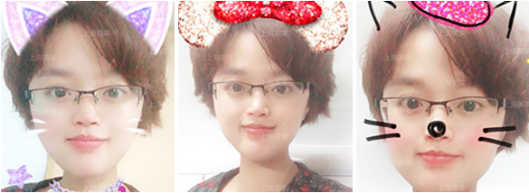 上海隆鼻的方式有哪些,什么方式比较好?