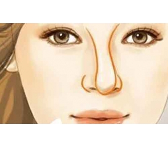 美莱打一次瘦脸针能管多久〢多可以注射几次