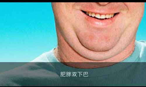 上海激光祛斑一次效果就能“治愈”祛斑吗?