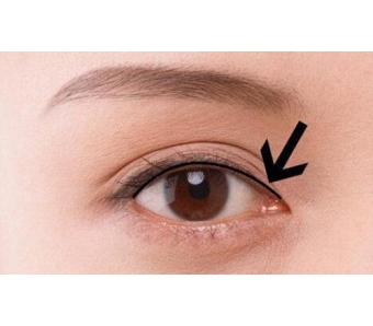 上海激光祛斑一次效果就能“治愈”祛斑吗?