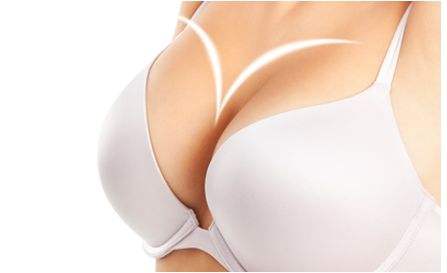 上海美莱科普|假体隆胸的三种切口,该如何选择