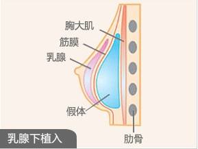 美莱做玻尿酸隆鼻，鼻梁会变宽吗