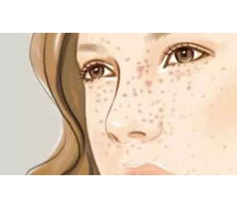 美莱一次水光=敷70次面膜,效果是真的好耶!