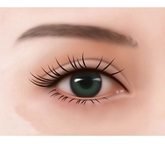 美莱脂肪胶精雕和传统自体脂肪相比有什么不同?