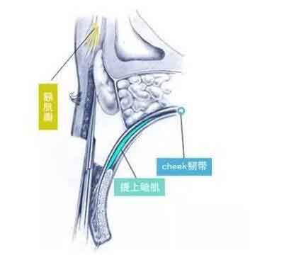 祛斑好方法,美莱有激光祛斑耶!