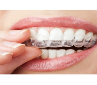 上海埋线双眼皮美莱的怎么样