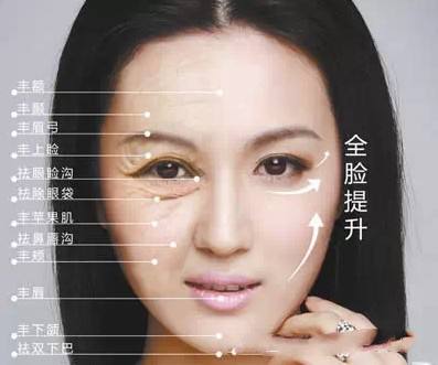 无针线雕做面部填充优势美莱有哪些？