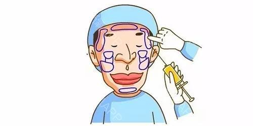 上海的美莱医院做私处脱毛一般多少钱？