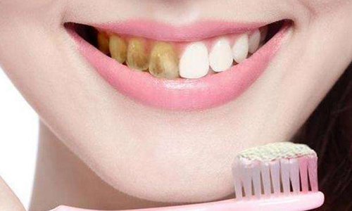 美莱祛除黄褐斑好的方法是什么