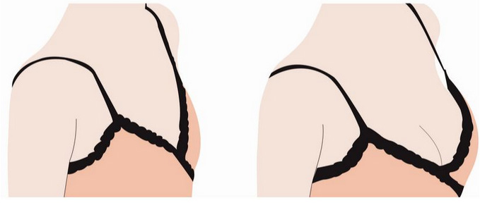 上海打玻尿酸能改变什么问题嘛