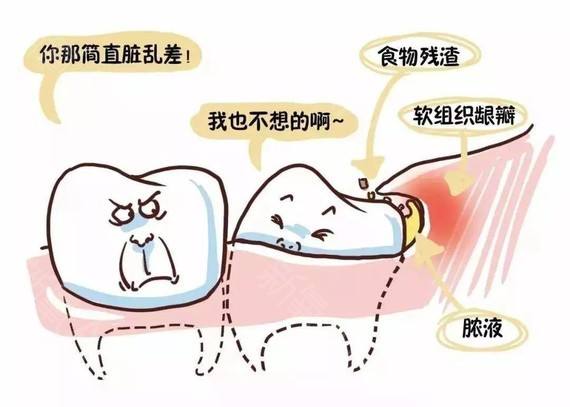 上海美莱纹眉之后还需要修眉或者画眉吗