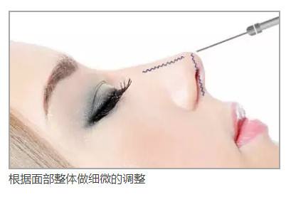 上海美莱纹眉之后还需要修眉或者画眉吗