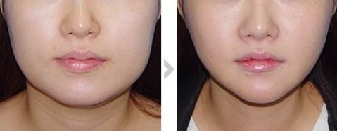 上海CE认证8大活肤效果