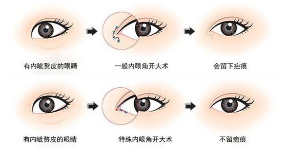上海隆鼻有哪几种方法,怎么选好呢
