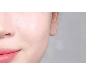 美莱科普丨玻尿酸吸收太快?有原因!