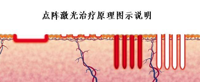 上海冷光美白牙齿技术优势都有哪些