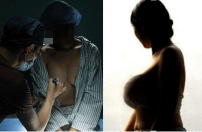 美莱玻尿酸注射丰脸有没有什么风险