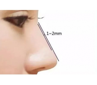 上海玻尿酸注射丰唇好吗,术后怎么护理?