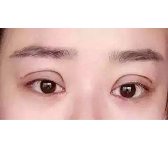 美莱抽脂适合什么样的身材!