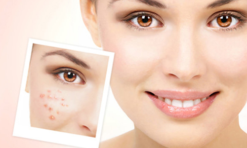 美莱医生告诉你!如何减臀部肥肉~